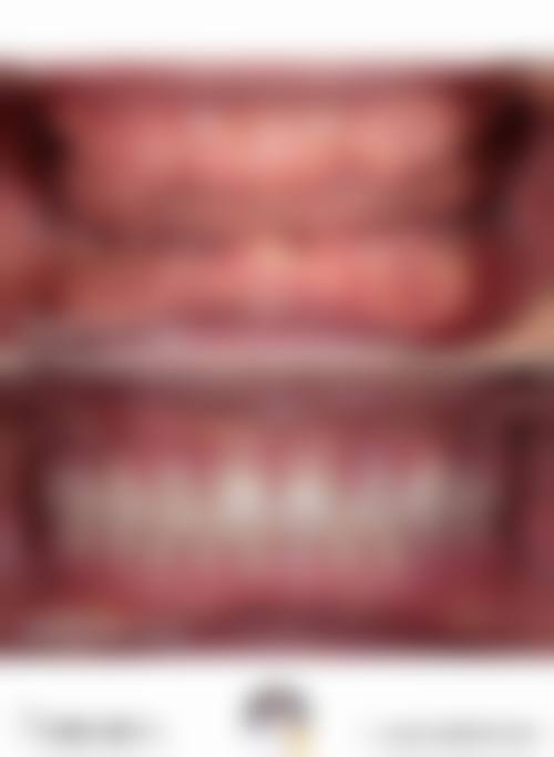 诊疗特色总结:周学东医生的治疗理念
