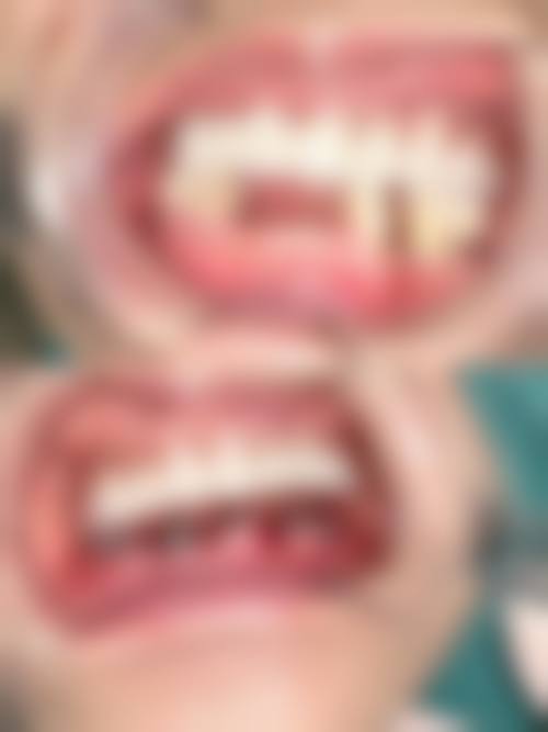 预约优惠活动:限时补贴详情