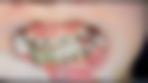 结尾预约号召重庆团圆口腔医院魏战军