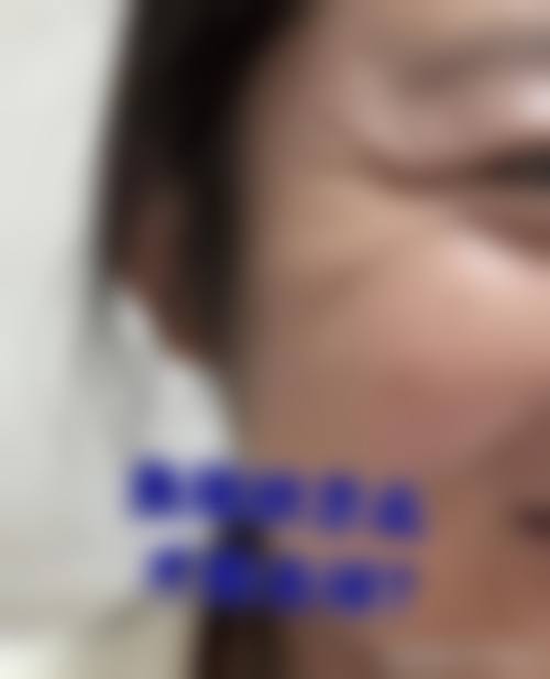 临床实例分享
