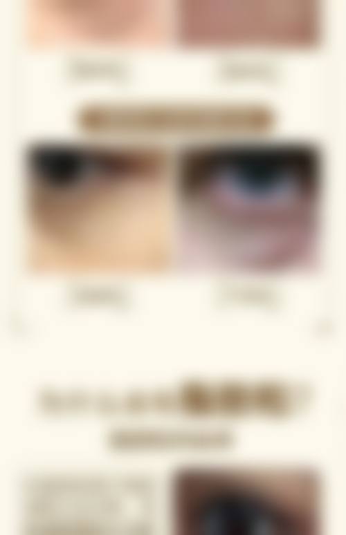 临床实例分享:石家庄美莱整形医院李秀格