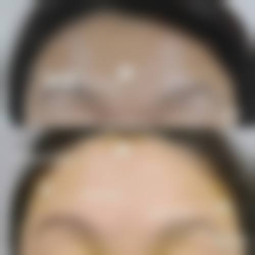 诊疗特色总结：于双全医生的技术优势