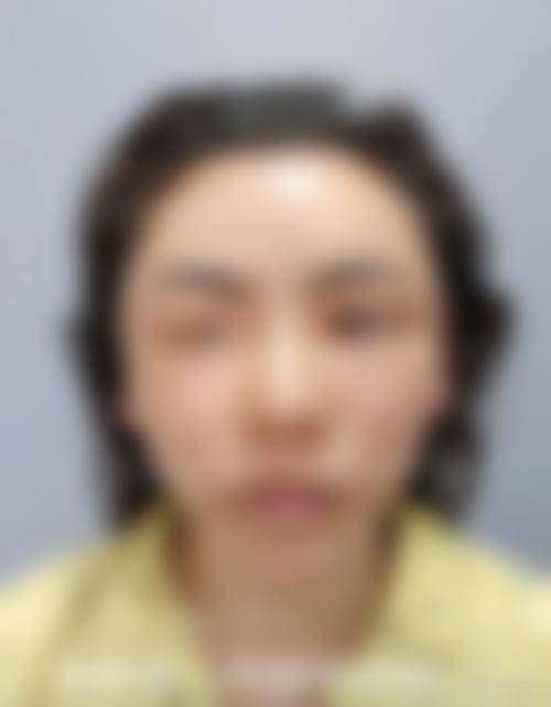 专精医护团队与贴心服务流程