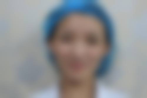 临床实例分享石家庄美莱整形医院王旭东