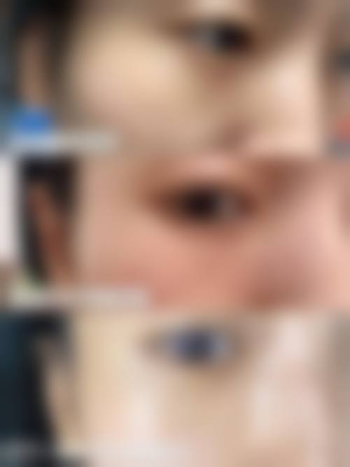 患者真实评价石家庄美莱整形医院王旭东