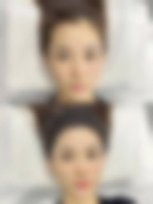结尾预约号召石家庄美莱整形医院王旭东