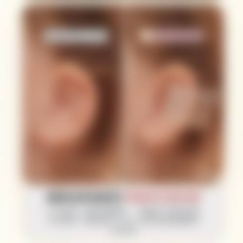 擅长项目详解:石家庄美莱整形医院李秀格