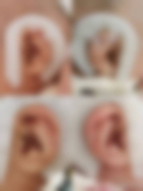 诊疗特色总结:石家庄美莱整形医院李秀格