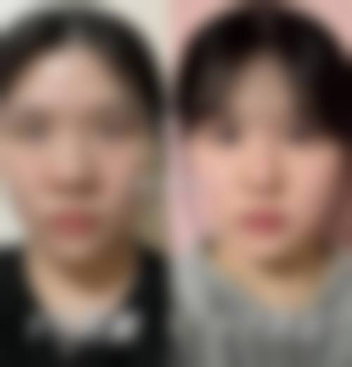 透明化价格体系，惠民优惠助力美丽升级