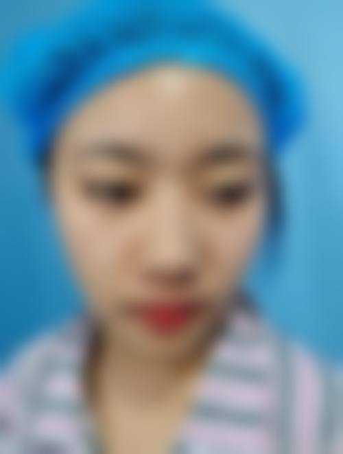 FAQ石家庄美莱整形医院王旭东