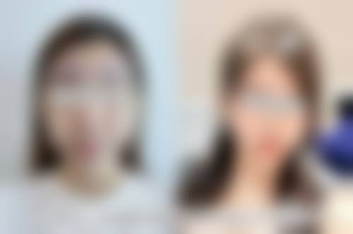 预约优惠活动：限时补贴不容错过