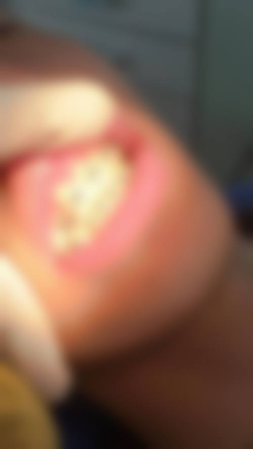 结尾预约号召:立即行动,重拾口腔健康