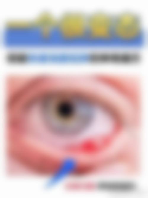 擅长项目详解:深圳市宝安区人民医院眼科牛玉玲擅长做什么?