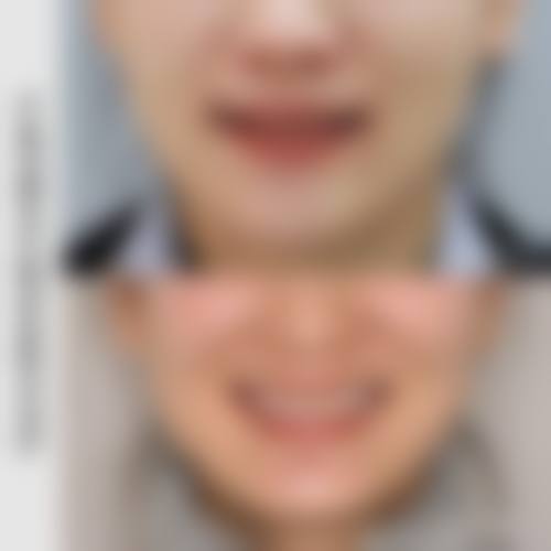 擅长项目详解