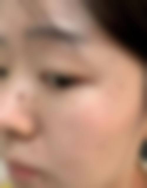 临床实例分享