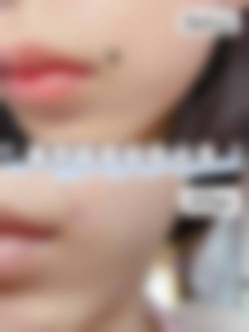擅长项目详解