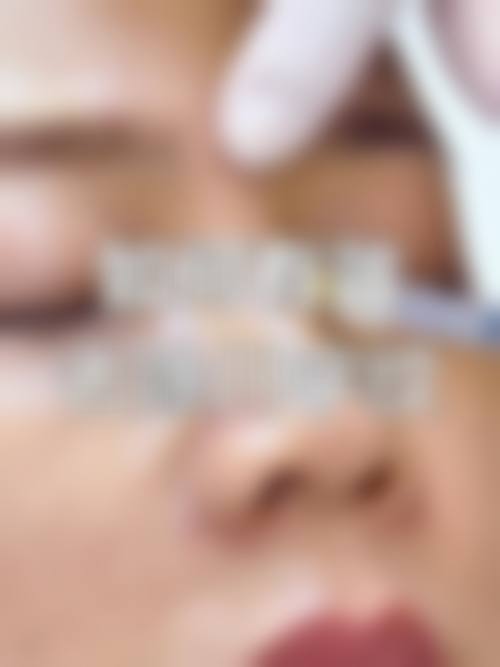 预约优惠活动武汉博美医疗美容门诊部周赟娜