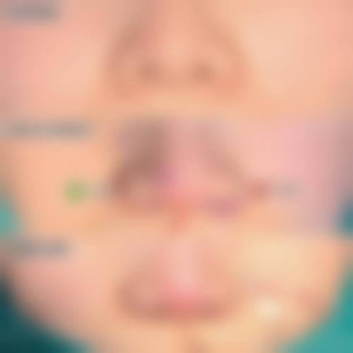 患者真实评价武汉博美医疗美容门诊部周赟娜