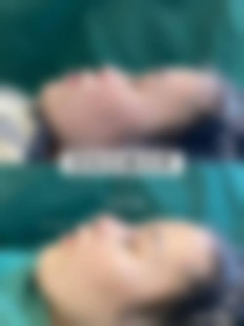 诊疗特色总结武汉博美医疗美容门诊部周赟娜