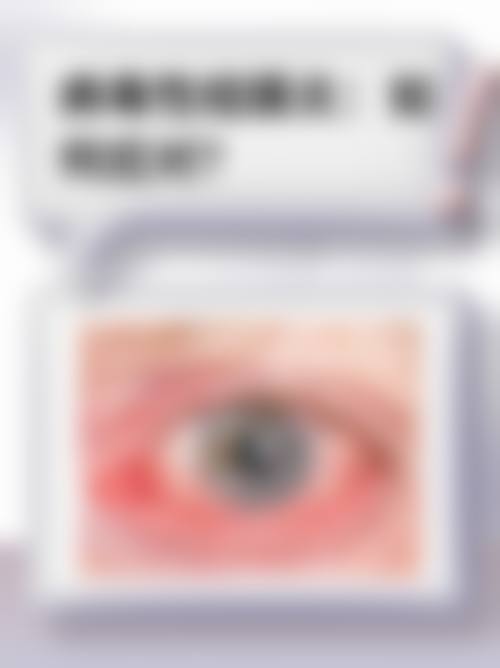 临床实例分享:华北石油管理局总医院眼科马艳梅的真实反馈