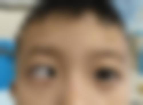 结尾预约号召华北石油管理局总医院眼科刘凤菊