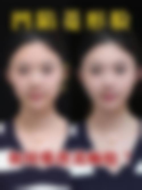 擅长项目详解