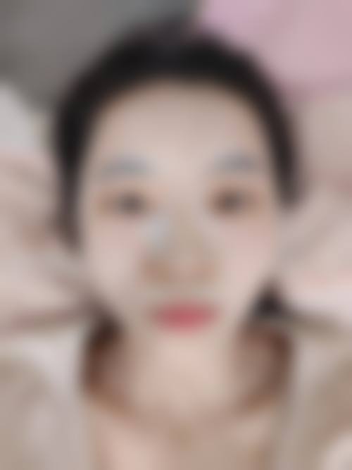 临床实例分享