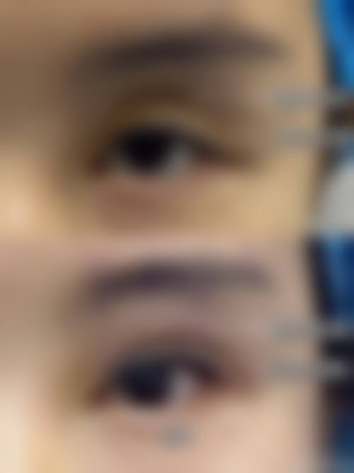 预约优惠活动