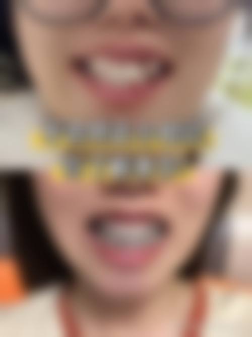 预约优惠活动