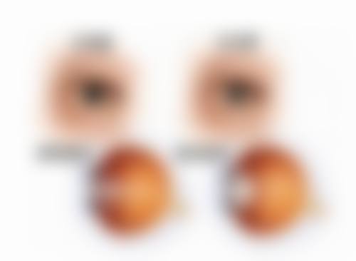 FAQ:邵阳市中 心医院眼科黄瑞尧常见问题