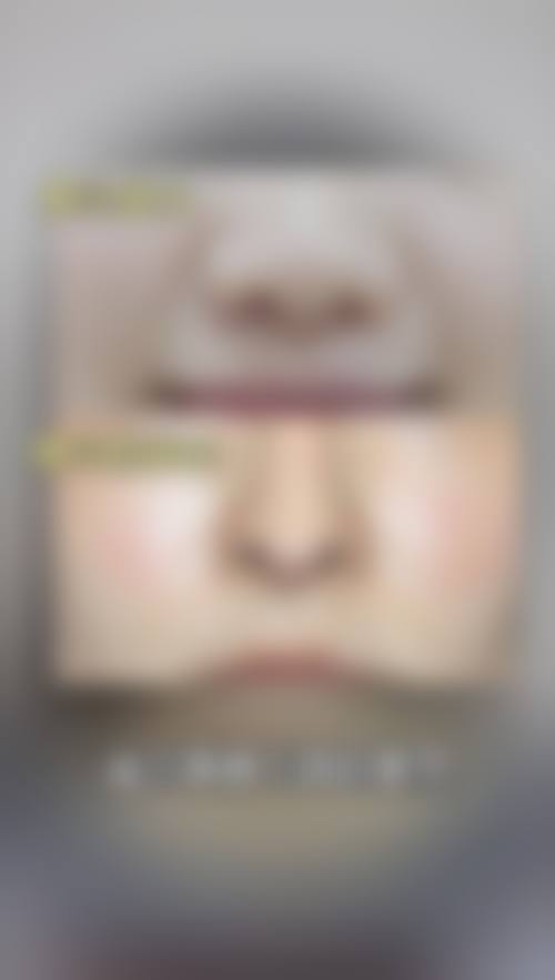 擅长项目详解石家庄美莱整形医院张颖