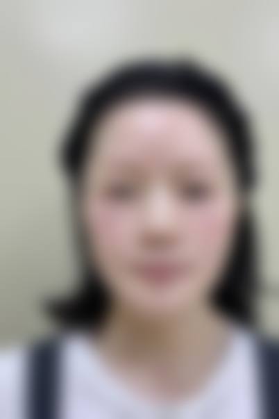 设备环境与安心保护:无菌操作守护健康底线