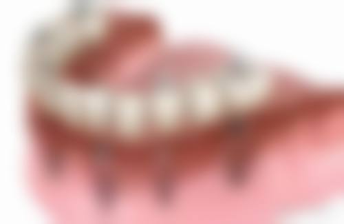 预约优惠活动:专属补贴不容错过