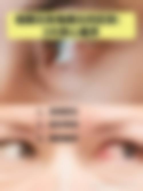 医院资质与设备实力:填补本地眼底手术空白