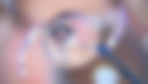 诊疗特色总结:华北石油管理局总医院眼科陈卫芳的服务理念