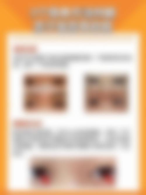 患者真实评价:华北石油管理局总医院眼科陈卫芳的口碑见证