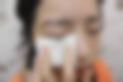 预约优惠活动石家庄美莱整形医院张颖