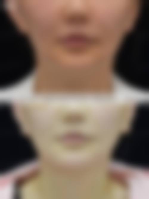 FAQ石家庄美莱整形医院张颖
