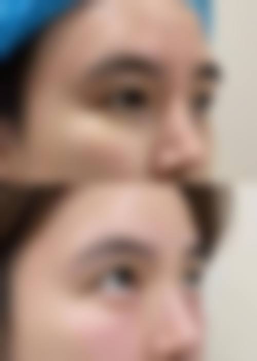 预约优惠活动:现在预约有什么补贴?