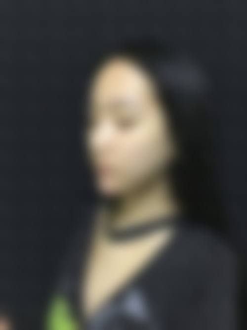 擅长项目详解:精细解决眼部难题