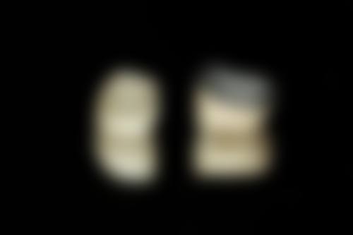 预约优惠活动:昆明蓝橙口腔(南亚院区)赵舒融