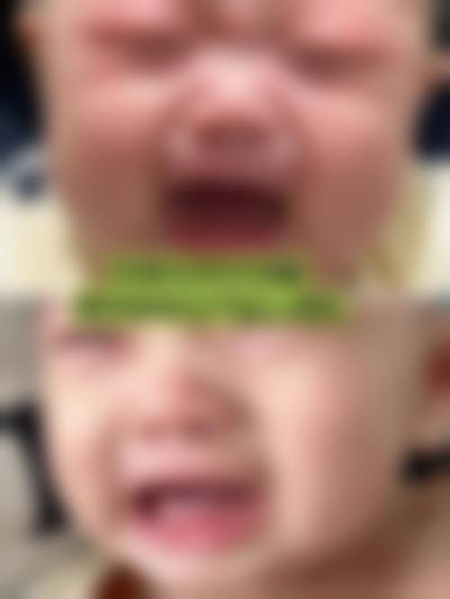 擅长项目详解:昆明蓝橙口腔(南亚院区)赵舒融