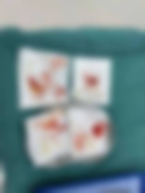 诊疗特色总结：于艳医生诊疗特色