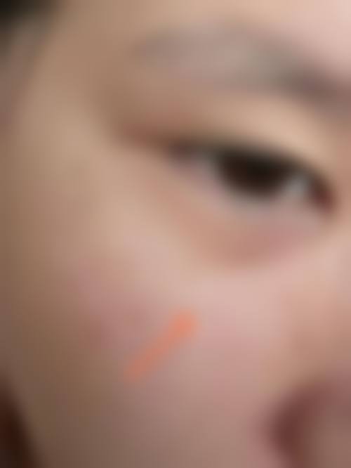 患者真实评价