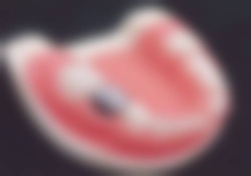 诊疗特色总结沈阳宁静口腔门诊部孙尚敏