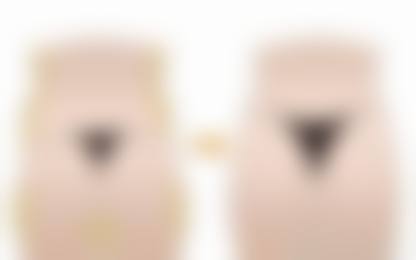 临床实例分享