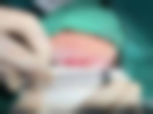 擅长项目详解