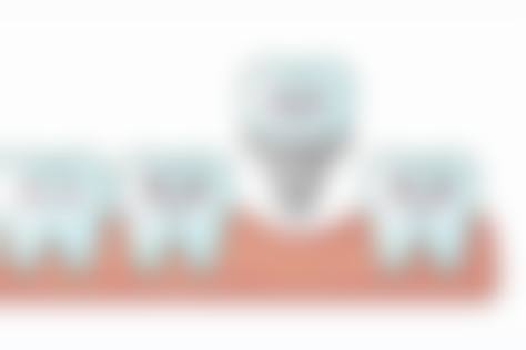 患者真实评价沈阳宁静口腔门诊部孙尚敏