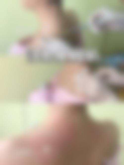 患者真实评价