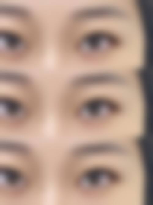 临床实例分享